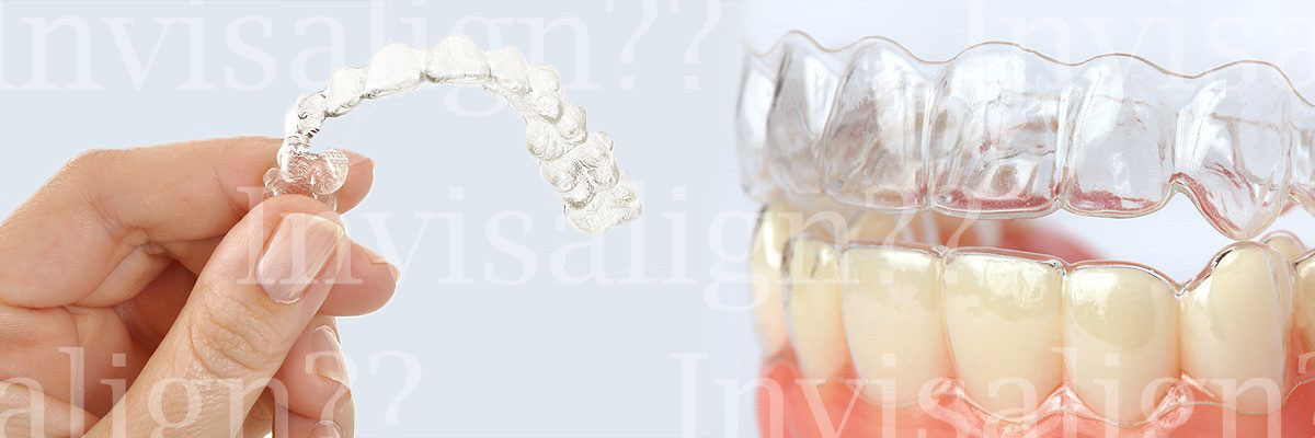 Sylmar Does Invisalign® Really Work?