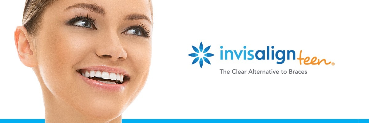 Sylmar Invisalign vs Traditional Braces