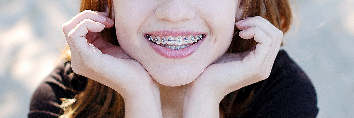 Sylmar Orthodontics