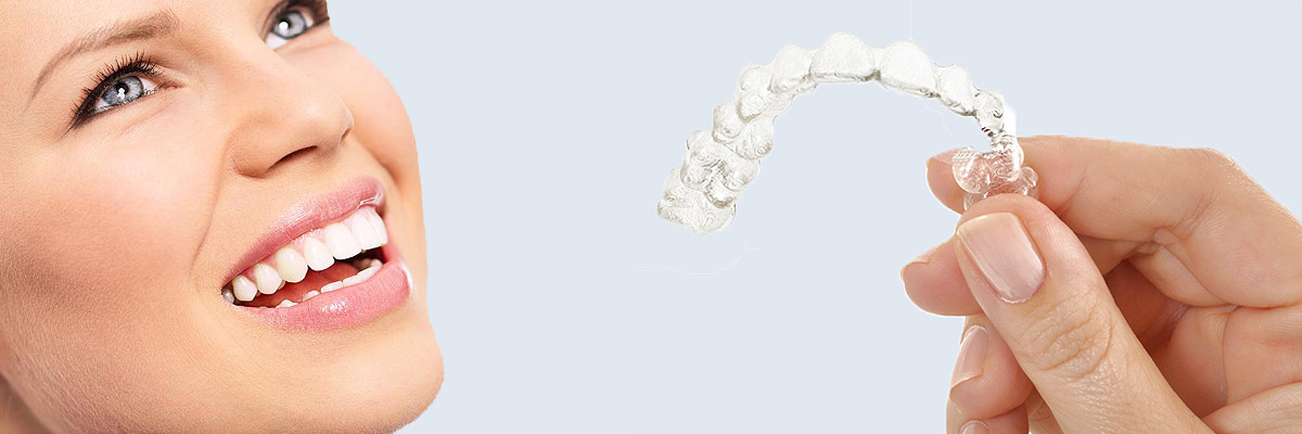 Sylmar 7 Things Parents Need to Know About Invisalign Teen