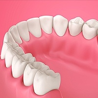 Periodontics Sylmar, CA