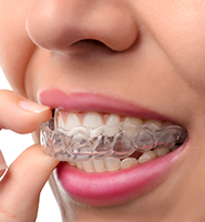 Clear Aligners - Almost Invisible Braces Sylmar, CA