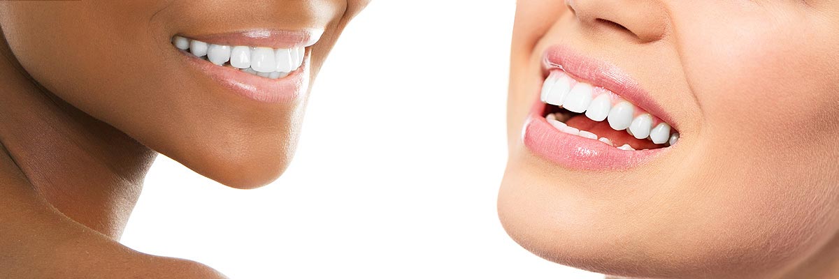 Sylmar Teeth Whitening