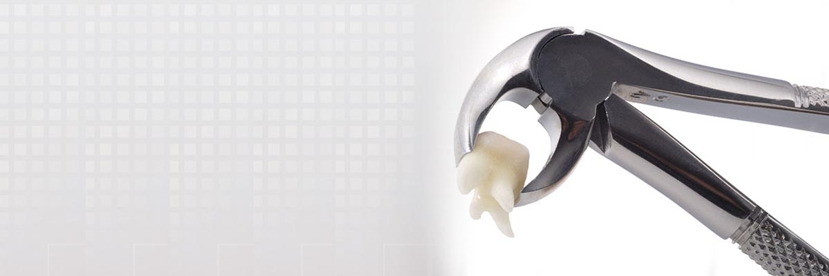 Sylmar Tooth Extraction